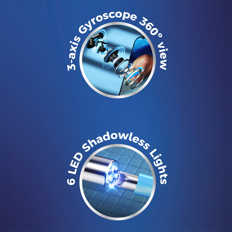 Nexxt HD Oorthermoscoop met Camera