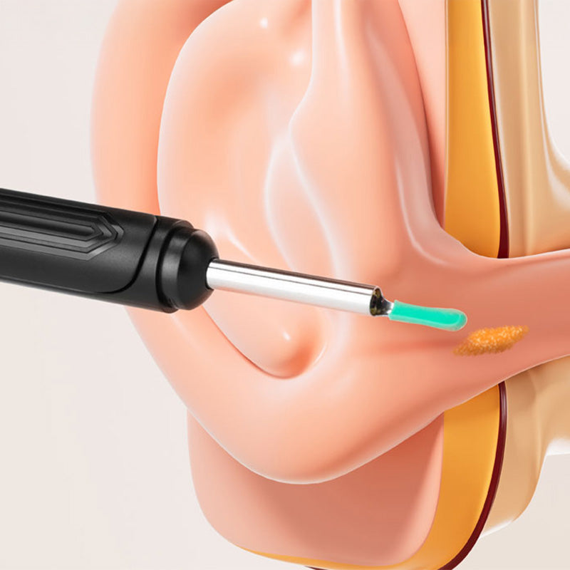 Nexxt HD Oorthermoscoop met Camera