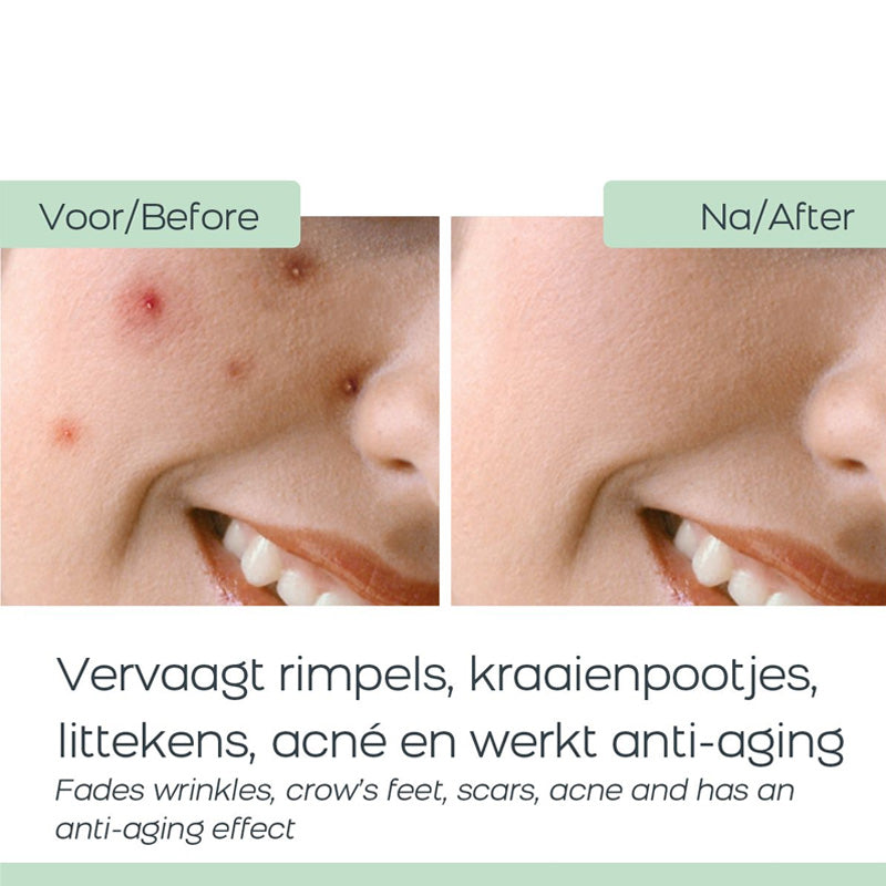 Orange Care Baba de Caracol Gezichtscrème – Slakkencrème voor Hydratatie & Huidherstel