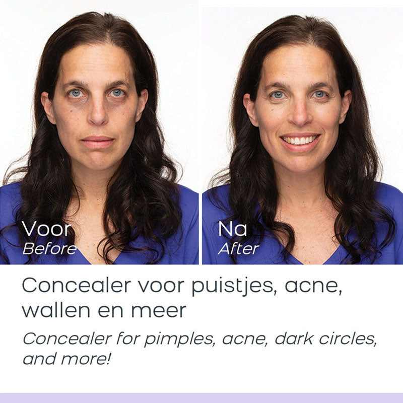 Smart Cover Concealer Kit Licht/Medium – Customizable Concealer Palette voor Perfecte Dekking